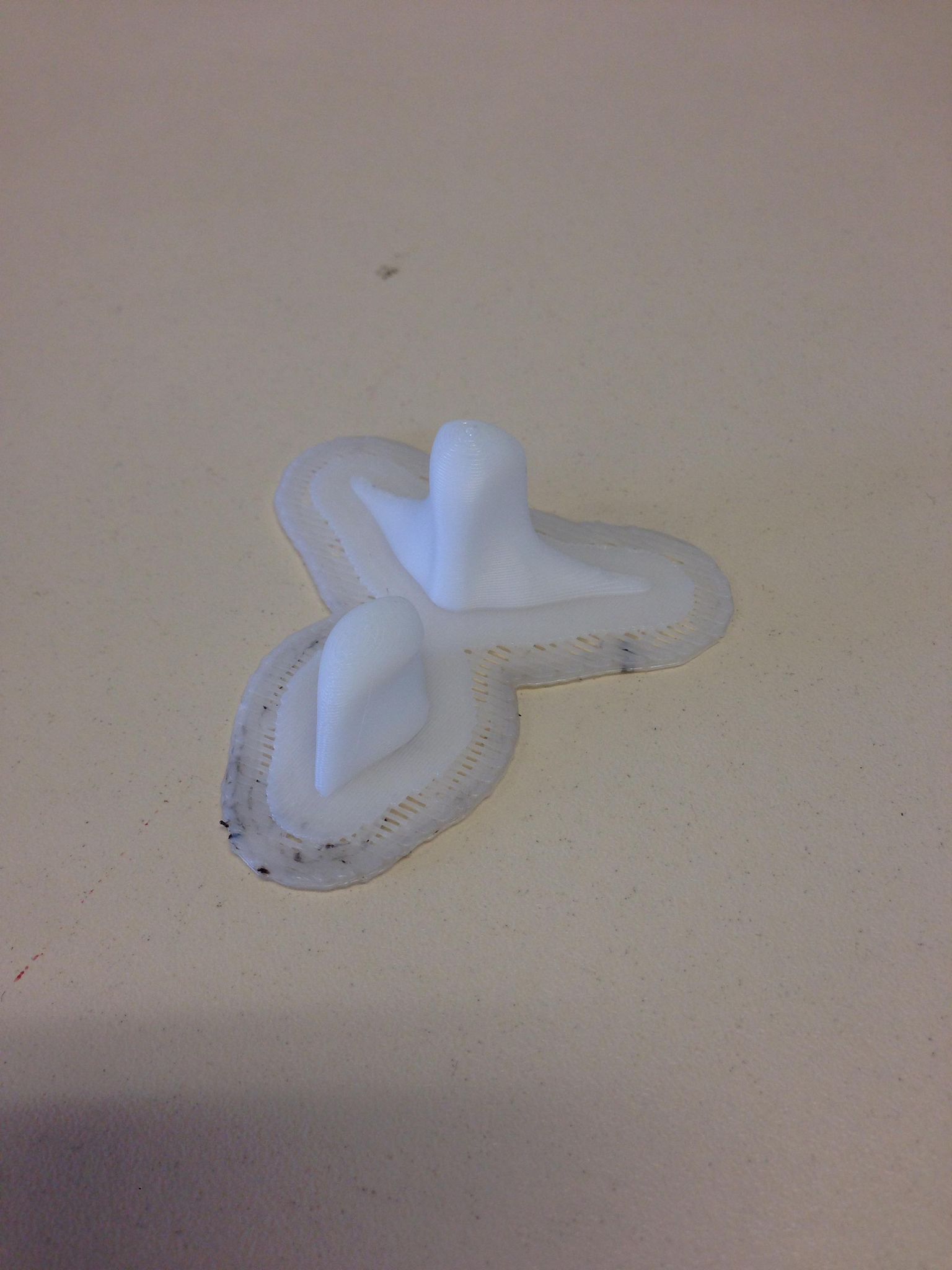 impression-3d-epine-dorsale.jpg